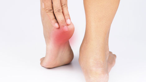 patient requiring plantar fasciitis treatment in Huntington
