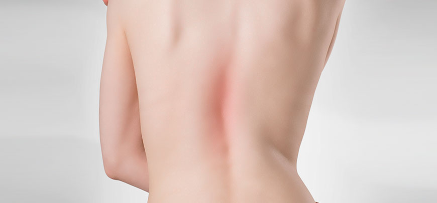 patient needing scoliosis treatment in Huntington