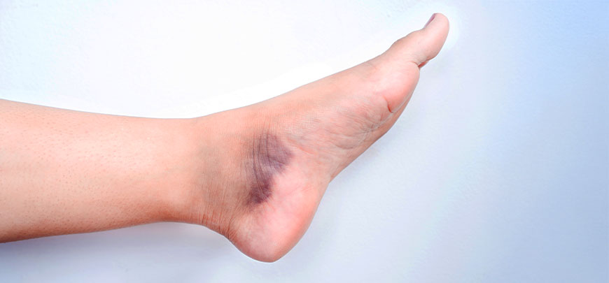 patient needing sprain treatment in Huntington
