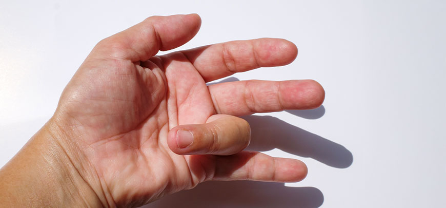patient needing trigger finger treatment in Huntington