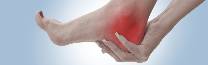 Plantar Fasciitis Chiropractors in Huntington