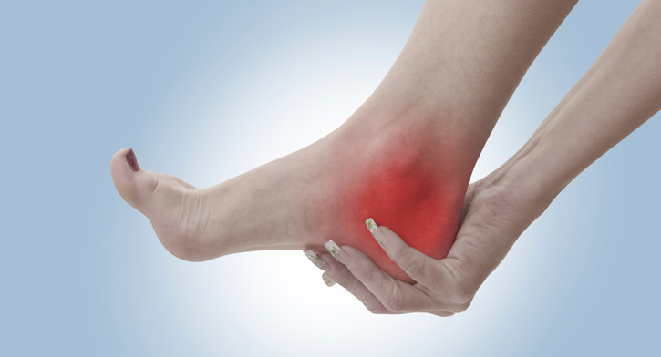 Huntington Plantar Fasciitis Chiropractor